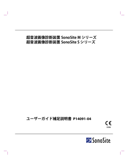 超音波画像診断装置 SonoSite M シリーズ 超音波画像診断装置
