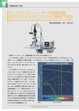 ピュアイエロー・レーザー光凝固装置 IQ577によるマイクロパルス閾値下
