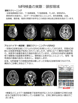 MRI検査の実際：頭部領域