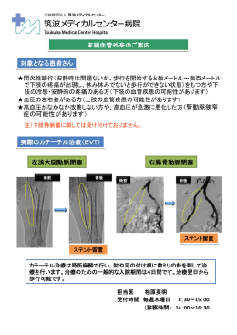 末梢血管外来のご案内 実際のカテーテル治療（EVT） 左浅大腿動脈