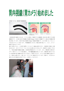 苦痛の少ない経鼻内視鏡検査