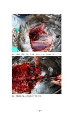 図7．左胸部－鎖骨の骨折、烏口骨の脱臼と内出血（左浅胸筋を