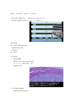 EL9-1 角化異常症 旭川医大 山本明美 正常な角層（掌蹠以外の） basket