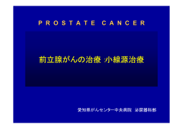 前立腺がんの治療：小線源治療