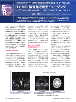 3T MRI脳脊髄液動態イメージング