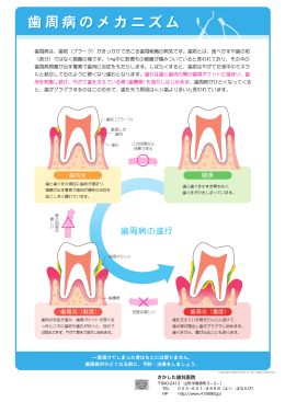 歯周病のメカニズム 歯周病のメカニズム