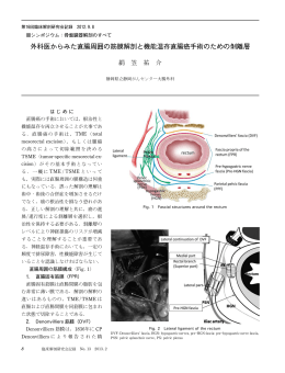 外科医からみた直腸周囲の筋膜解剖と機能温存直腸