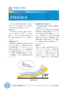 誤嚥性肺炎 - 日本呼吸器学会