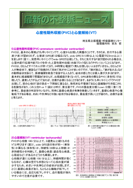心室性期外収縮（PVC）と心室頻拍（VT）
