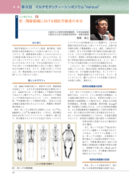 骨・関節領域における核医学検査の本分