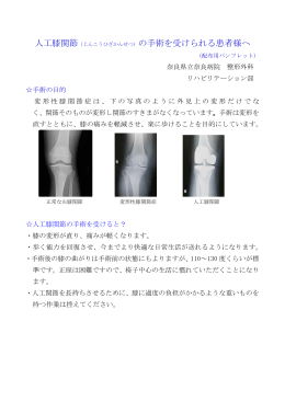 人工膝関節（じんこうひざかんせつ）の手術を受けられる患者様へ
