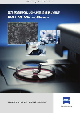 PALM MicroBeam