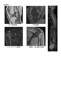 整形領域 前十字靱帯断裂 半月板損傷 インピンジメント症候群 骨挫傷 +