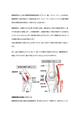 腸脛靭帯炎は、別名「腸脛靭帯摩擦症候群」や「ランナー膝」、「ランナーズ