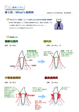 第2回：What`s 歯周病