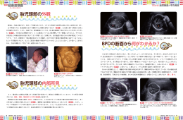 胎児頭部の外観 胎児頭部の内部所見
