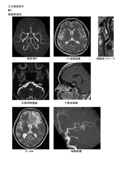 主な検査紹介 MRI 頭頚部領域 頭部 MRA T2 強調画像 頸動脈プラーク