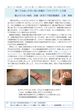 薄くて出血しやすい弱い皮膚は「スキンテア」 - 富山労災病院