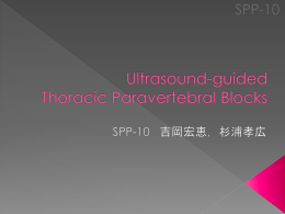 Thoracic paravertebral blocks