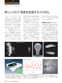 新しいOCT用途を加速するVCSEL - Laser Focus World Japan