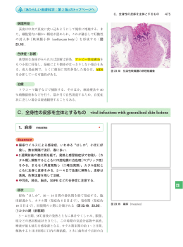 2З C．全身性の皮疹を主体とするもの viral infections with generalized