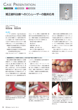 矯正歯科治療へのCO2レーザーの臨床応用