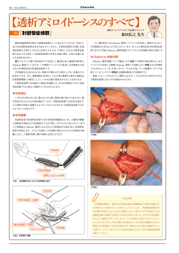 肘部管症候群 - 森田シャントアミロイド治療クリニック