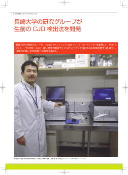 長崎大学の研究グループが 生前の CJD 検出法を開発