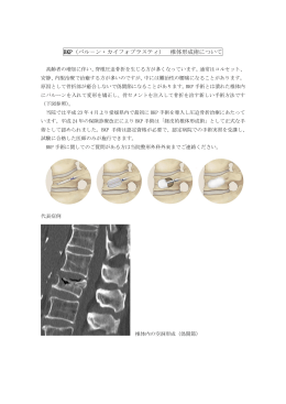 BKP（バル－ン・カイフォプラスティ） 椎体形成術について