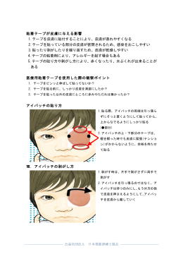 一般の方向け - 日本視能訓練士協会