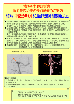 脳血管内治療について（PDF：182KB）