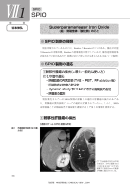 1 転移性肝腫瘍の検出 SPIO製剤の種類 SPIO製剤の適応