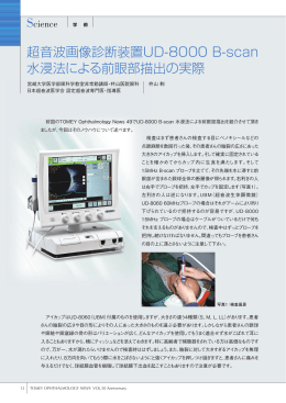 超音波画像診断装置UD-8000 B-scan 水浸法による前眼部