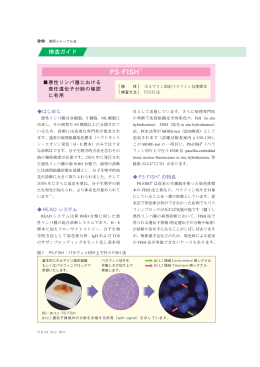 検査ガイドPS-FISH ® (微研ジャーナル友2011.4月号 VOL.34 NO.2掲載)