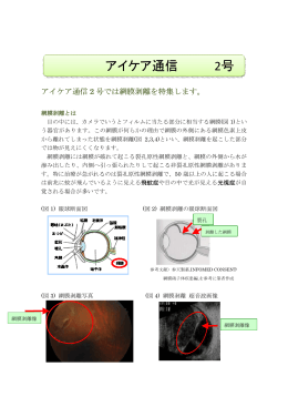 アイケア通信2号