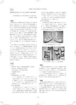 無痛無汗症患者に対する両下肢装具の製作経験 O-4