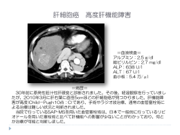 肝細胞癌 高度肝機能障害
