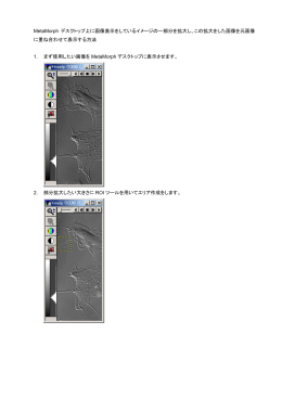 MetaMorph デスクトップ上に画像表示をしているイメージの一部分を拡大