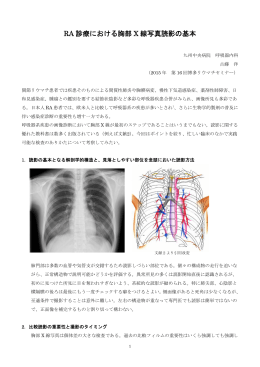 RA 診療における胸部 X 線写真読影の基本
