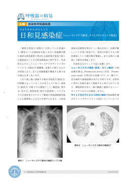 呼吸器の病気 - 日本呼吸器学会