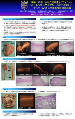 進行性腎癌に対するSorafenibによる手足症候群の病理組織