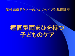 痙直型両麻痺を持つ子どもとは