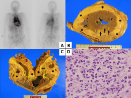 入院時画像所見 - Journal of Medical Case Reports