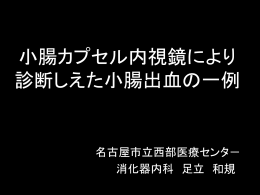 小腸カプセルにより診断した 小腸出血の一例