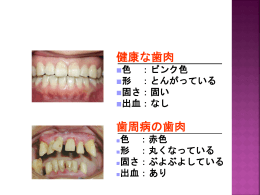 1 歯周病とは 健康な歯肉 色 ：ピンク色 形 ：とんがっている 固さ：固い