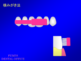 ブラッシング方法