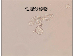 性腺分泌物 - 千葉県臨床検査技師会