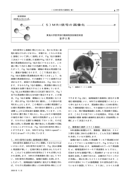 （5）MRI信号の画像化