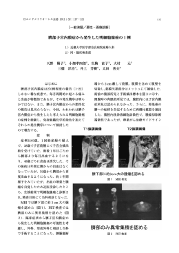 臍部子宮内膜症から発生した明細胞腺癌の1例