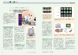 6. 人体臓器の機能を画像化する &minus;核医学診断装置